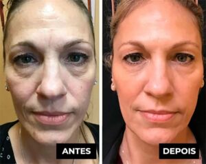 Placenta Glow – Cápsulas Rejuvenescedoras