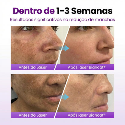 Sérum facial Biancat com probióticos