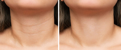 Creme Lifting Firmador Remover Rugas em 60 segundos